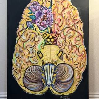 Olfactory Meningioma