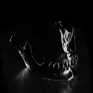 Metallicize Your Mandible